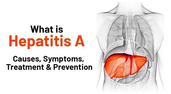 Hepatitis A; It's Causes, Symptoms, Treatment & Prevention