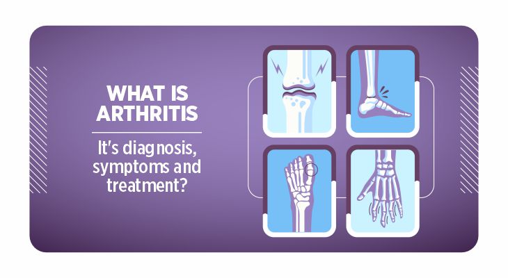 Arthritis diagnosis, symptoms & treatment