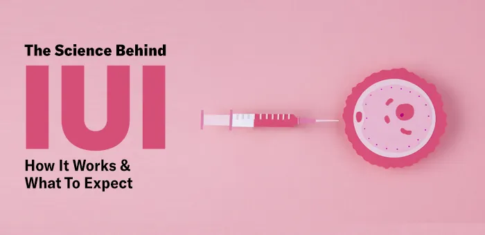 iui