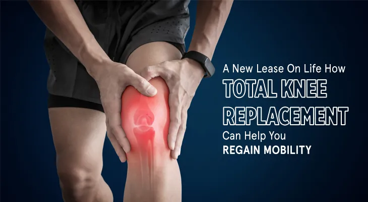 total knee replacement