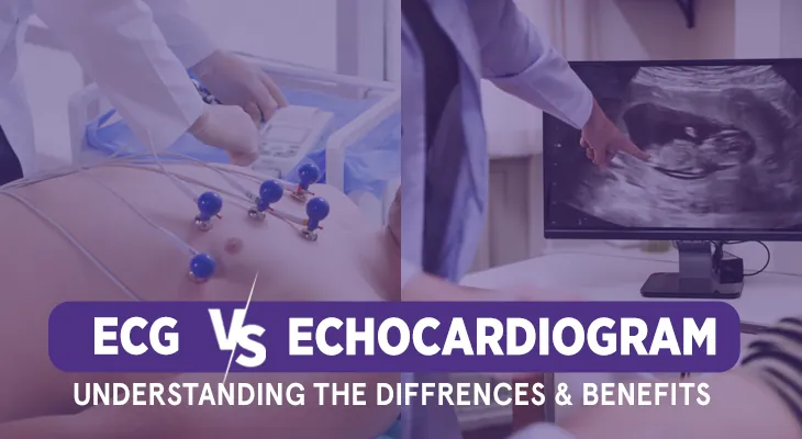 ECG vs ECHO