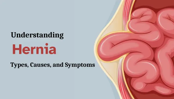 Understanding Hernia