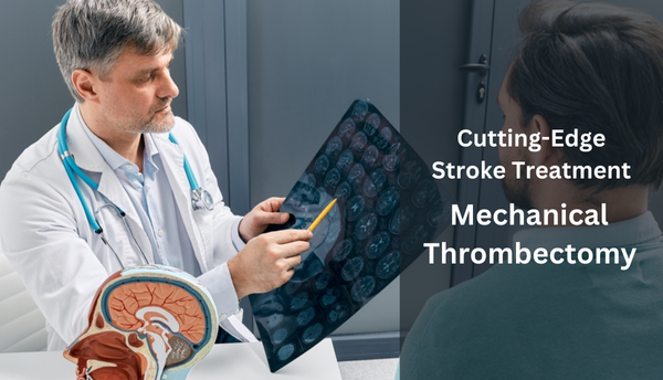 Stroke Treatment with Mechanical Thrombectomy