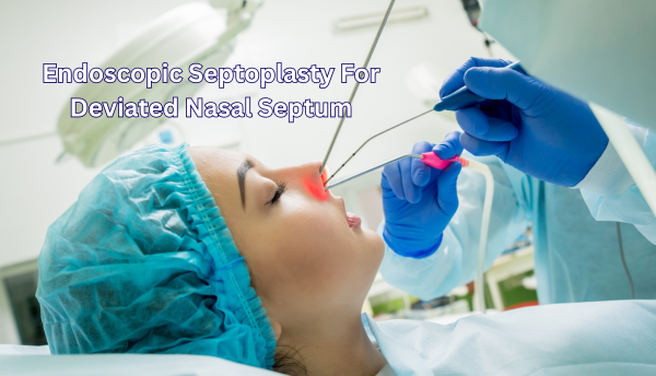 Endoscopic septoplasty for Deviated nasal septum