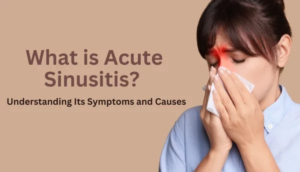 Acute Sinusitis: Symptoms and Causes